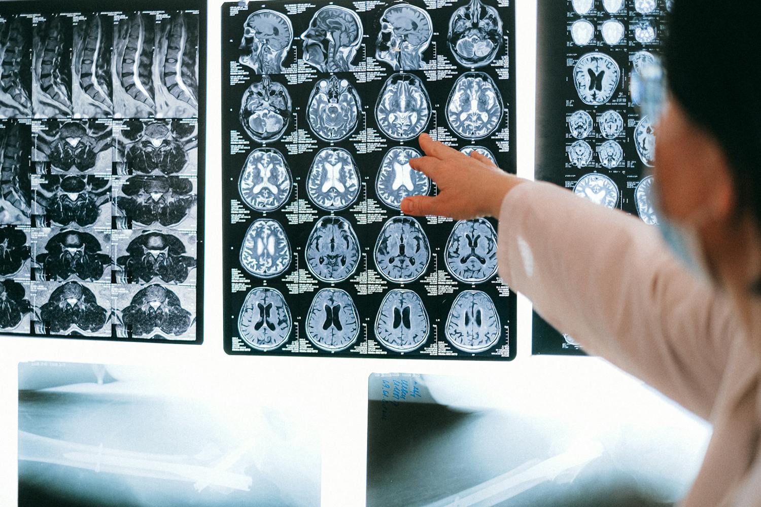 Medizinische Untersuchung - Neurochirurgische Behandlung in der Praxis
